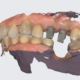 Digitális, háromdimenziós szájszkenner rendelőnkben.