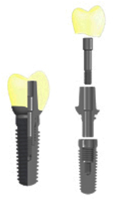 CAMLOG® SCREW-LINE típusú implantátum