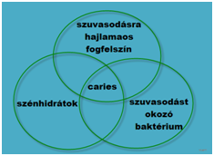 Fogszuvasodás (caries) folyamata